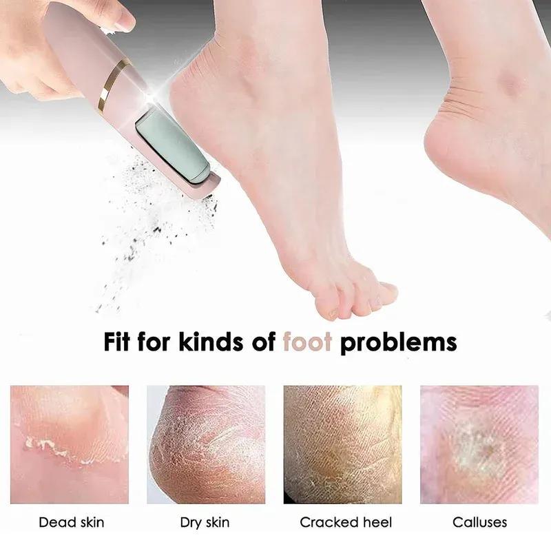 Electric Foot Callus Remover and Pedicure Grinder - Gamplanet