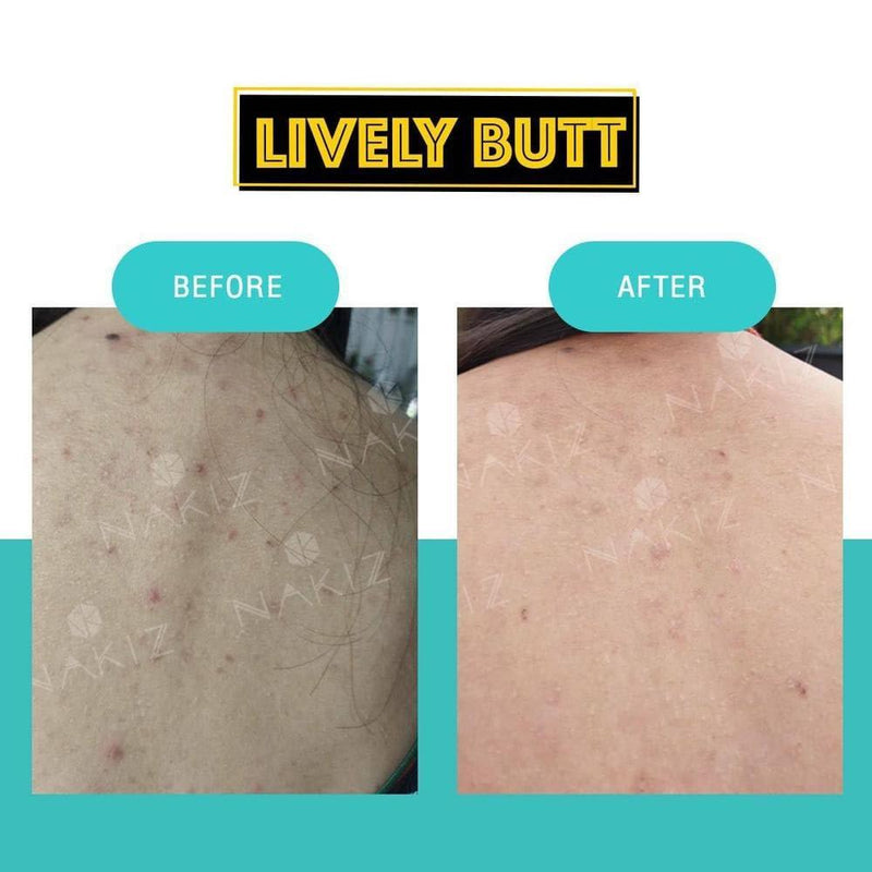 Nakiz Lively Butt Cream - Gamplanet